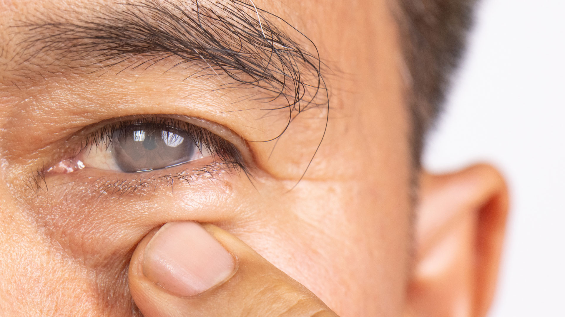 Cataratta: quando è il momento di intervenire