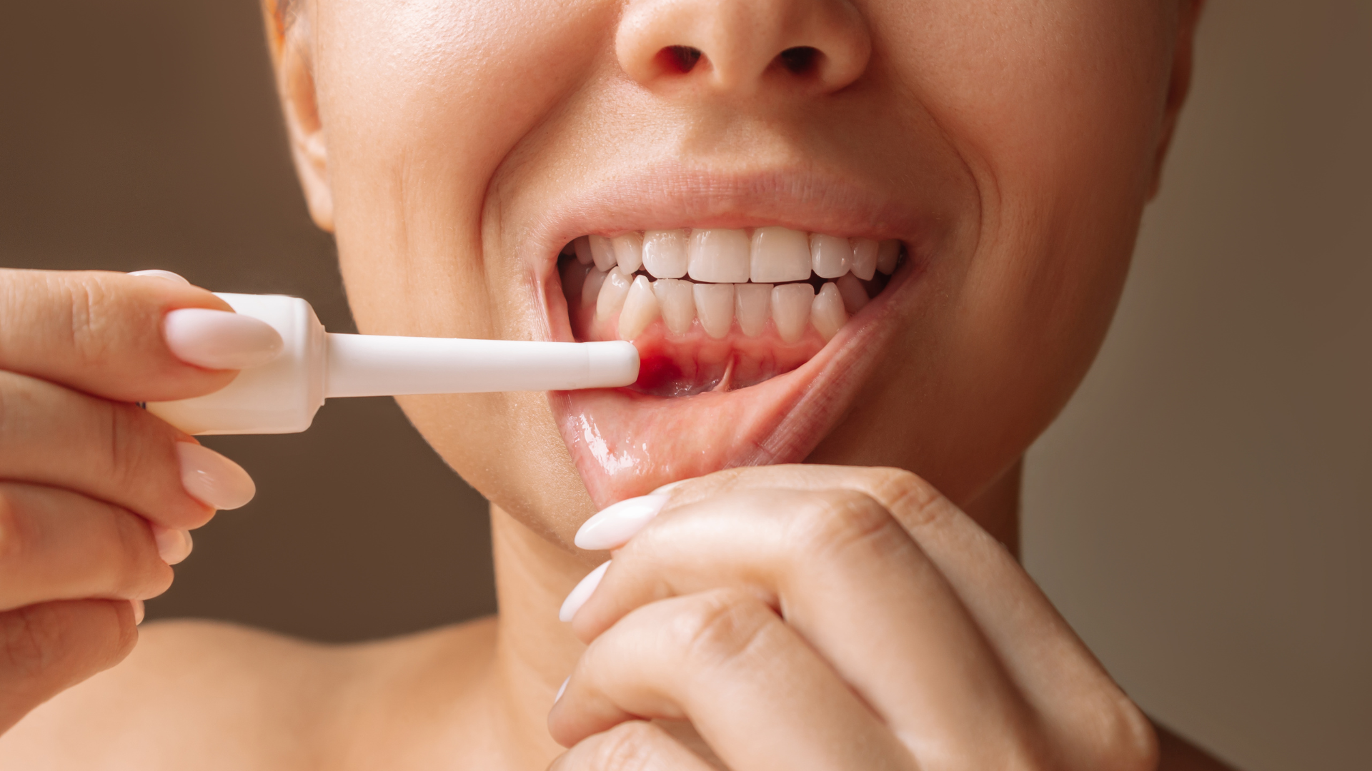 Parodontite: cos’è e perché non va sottovalutata